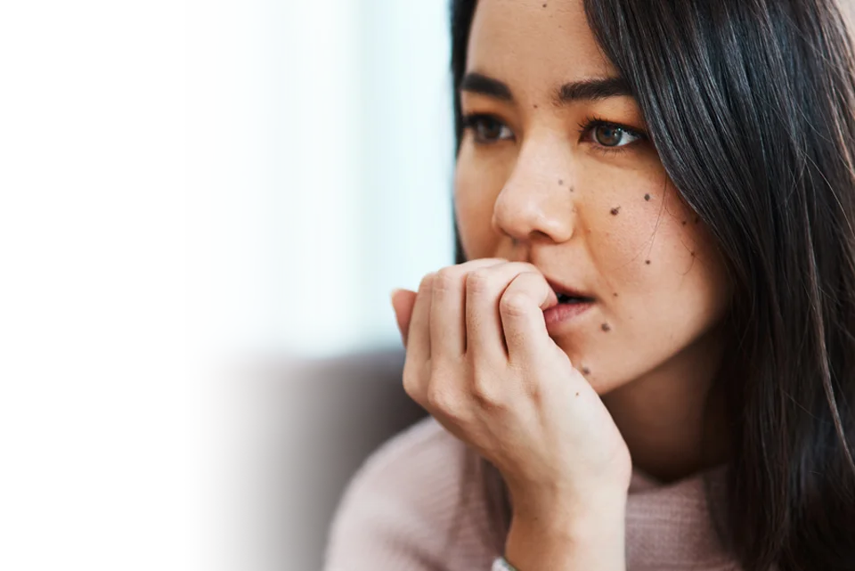 Seboroik keratosis adalah bintik kulit jinak seperti kutil